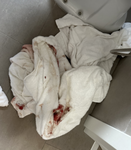 bloody towels